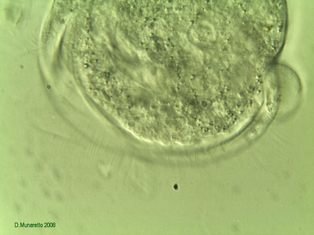 Rieccomi...con Vorticella Gigante a 630x !